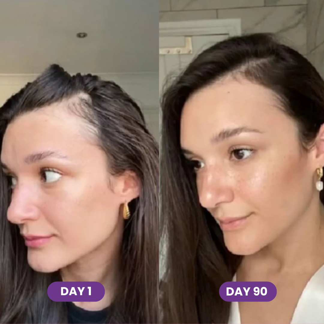 Hair Accelerator Soft Chews